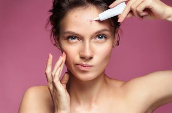 Does Salicylic Acid Fight Acne?